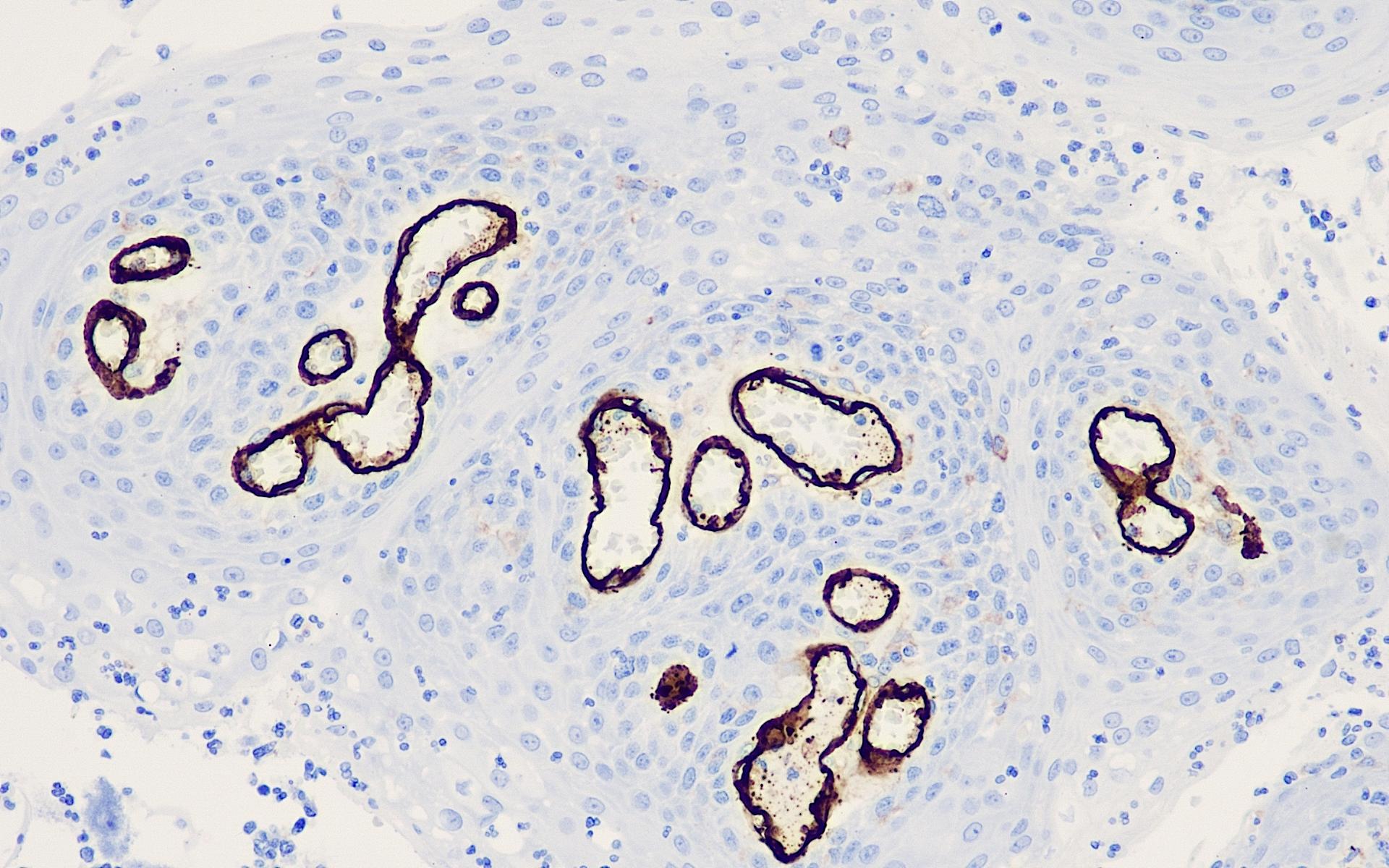 CD105 20-2 扁桃体