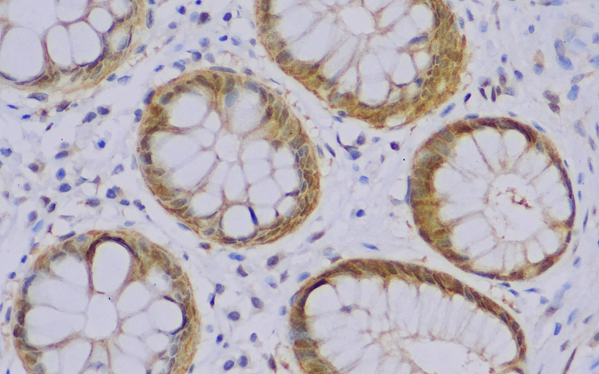 DPC4(JRMR-105) 大肠-2